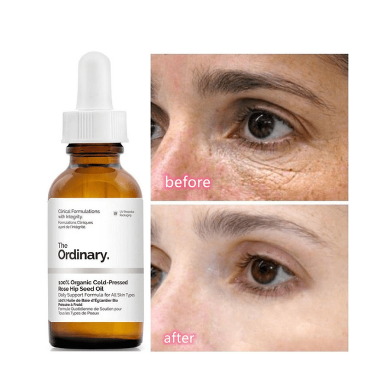 Caiffeine solution 5% + EGCG 30 Ml