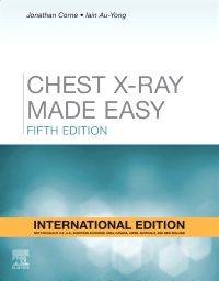 Chest X-Ray Made Easy, International Edition 2022
