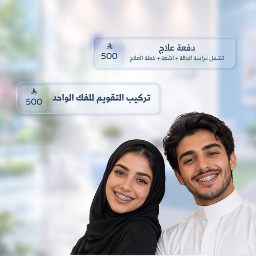 دفعة علاج التقويم 