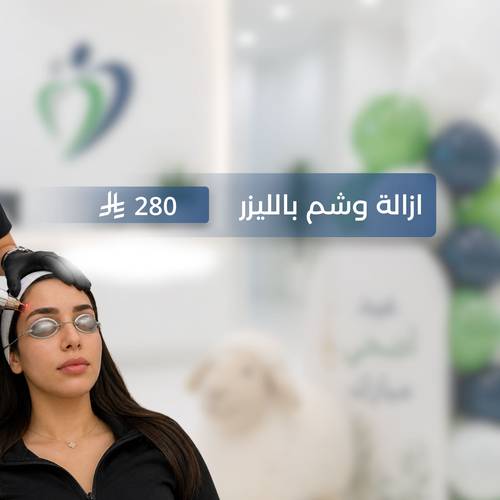 عيد الأضحى..  ازالة الوشم 