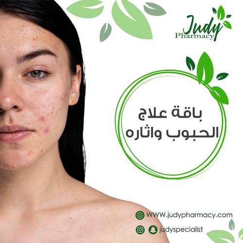 باقة حب الشباب العلاجية