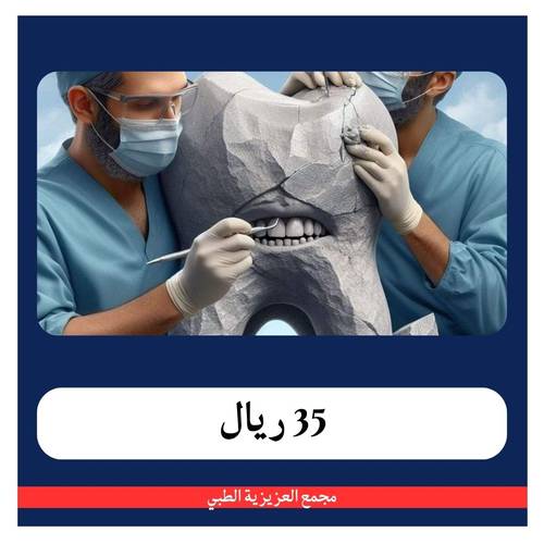 عرض الحشوة التجميلية للسن الخلفي ب 125 ريال - دفعة أولى 35 ريال - مجمع العزيزية الطبي 