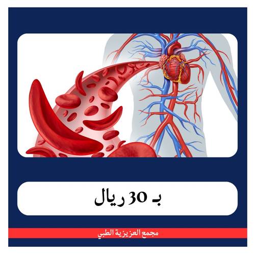 باقة الانيمياء بــ 180 ريال - دفعة اولى 30 ريال - مجمع العزيزية