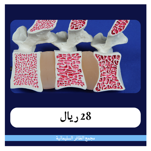 تحاليل هشاشة العظام 280 ريال - دفعة أولى 28 ريال - مجمع الظافر الطبي 1
