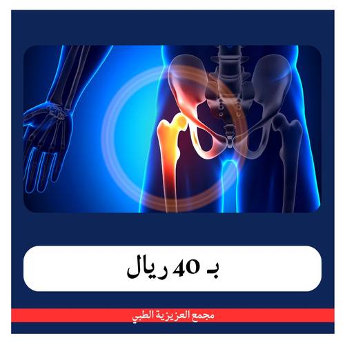 باقة ليونة العظام بــ 490 ريال - دفعة اولى 40 ريال - مجمع العزيزية
