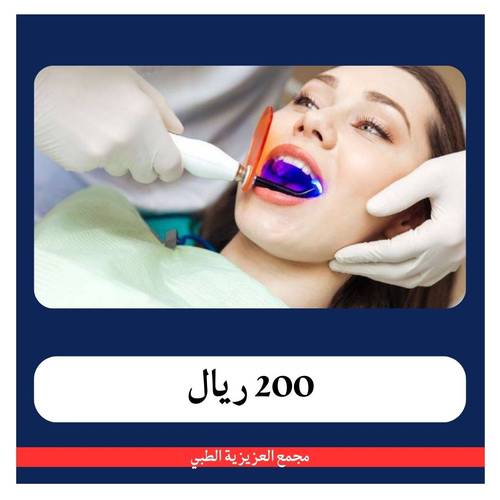 تركيب جسر من 4 اسنان شامل الكشف و الخطة العلاجية 1400 ريال - دفعة اولى 200 ريال - مجمع العزيزية
