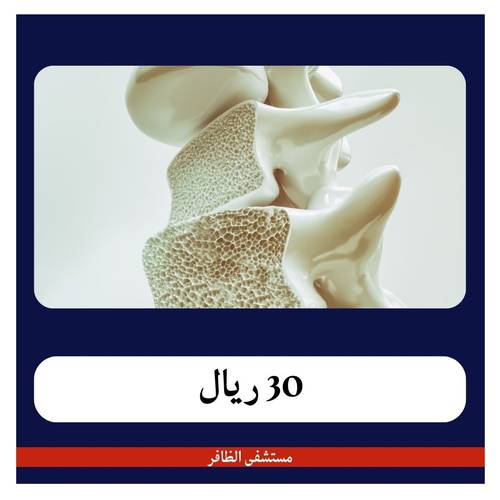 مجموعة تحاليل هشاشة العظام 229 ريال - دفعة أولى 30 ريال - مستشفى الظافر