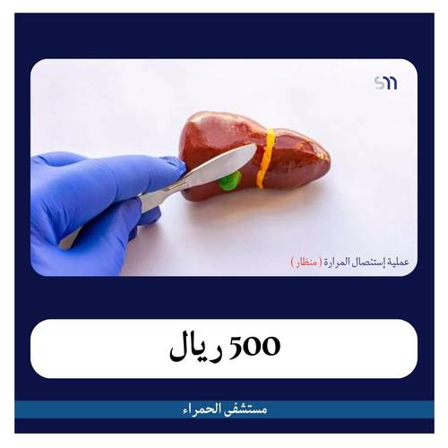 عملية استئصال المرارة منظار بـ 8000 ريال دفعة اولى 500 ريال مستشفى الحمراء