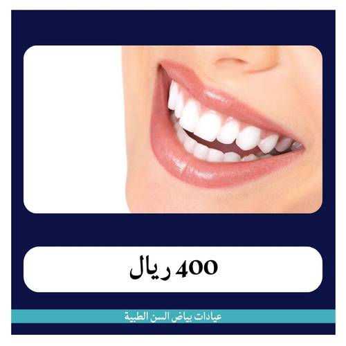 سن بروسلين ب400 ريال - دفعة أولى 50 ريال 