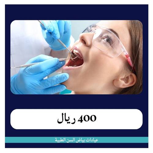 العصب الخلفي ب400 ريال - دفعة أولى 50 ريال 