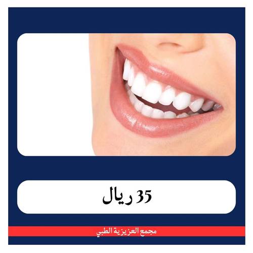 تركيب تاج بورسلين شامل الكشف والخطة العلاجية بـ 285 ريال - دفعة اولى 35 ريال - مجمع العزيزبة