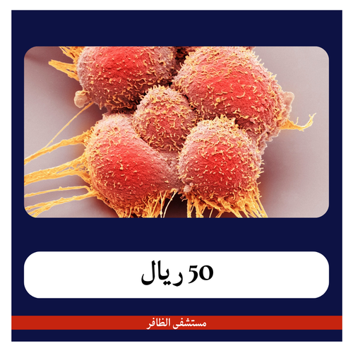 تحاليل الكشف المبكر عن أورام البروستات بـ 450 ريال - دفعة أولى 50 ريال - مستشفى الظافر