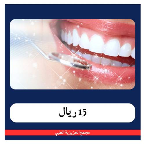 عرض تنظيف الأسنان ب 75 ريال - دفعة أولى 25 ريال - مجمع العزيزية