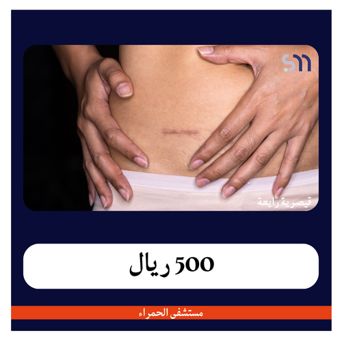 قيصرية رابعة بـ 8300 ريال دفعة اولى 500 ريال مستشفى الحمراء