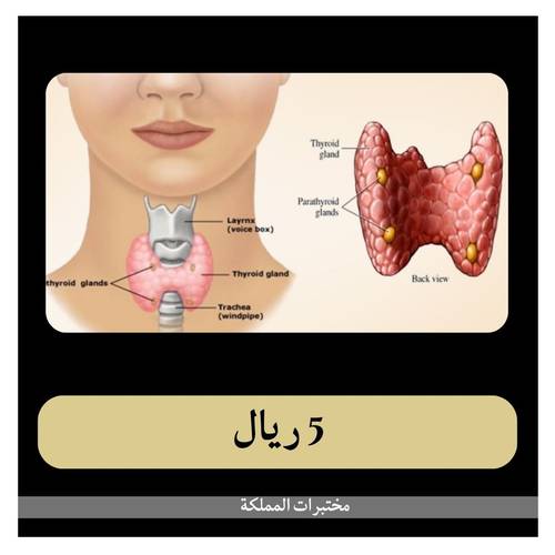 باقة الغدة الدرقية ب 113 ريال - دفعة أولى 5 ريال - مختبر خلود للتحاليل الطبية