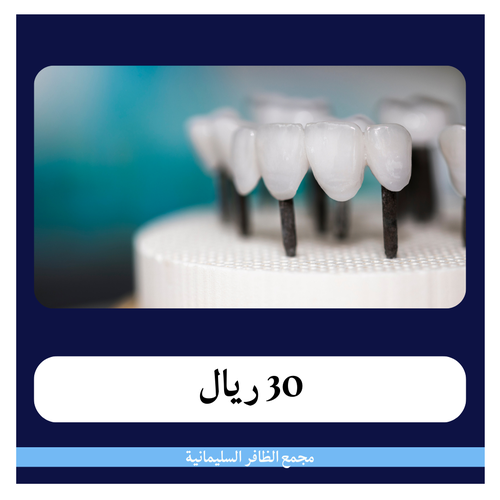 تركيب بورسلين 340 ريال - دفعة أولى 30 ريال - مجمع الظافر الطبي 1