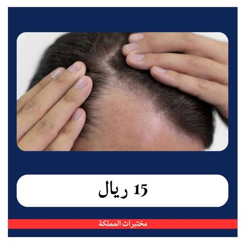 تساقط الشعر + الفحص الشامل ب 195 ريال - دفعة أولى 19 ريال - مختبرات المملكة