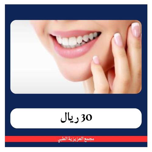حجر كريستال لتزيين الابتسامة بـ 130 ريال - دفعة اولى 30 ريال - مجمع العزيزية