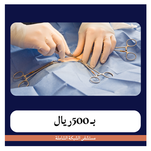 عملية إزالة كيس المبيض عن طريق فتح البطن  بـ6500 دفعة اولى 500 ريال مستشفى الشبكة الشاملة