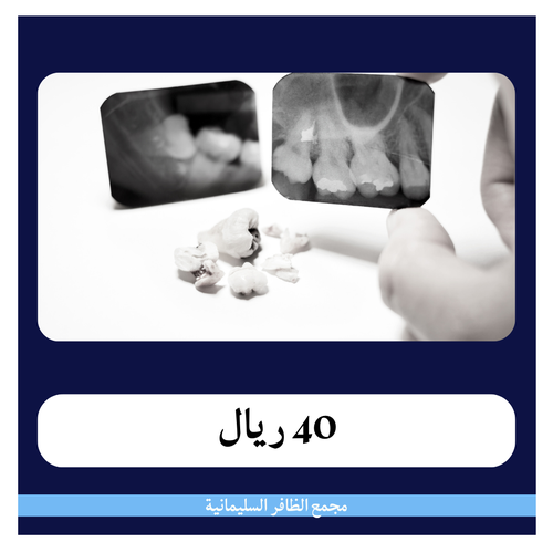 علاج عصب أمامي 440 ريال - دفعة أولى 40 ريال - مجمع الظافر الطبي 1