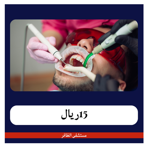 تلميع الأسنان  105 ريال - دفعة أولى 15 ريال - مستشفى الظافر