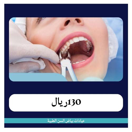 خلع جذر بسيط 130 ريال - دفعة أولى 30 ريال 
