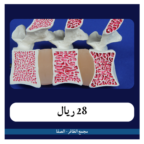 تحاليل هشاشة العظام 280 ريال - دفعة اولى 28 ريال - مجمع الظافر الطبي 2