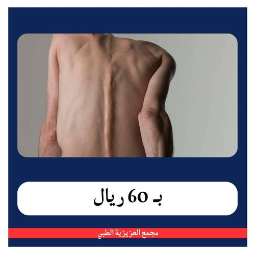 باقة النحافة و قصر القامة بـ 260 ريال - دفعة اولى 60 ريال - مجمع العزيزية 