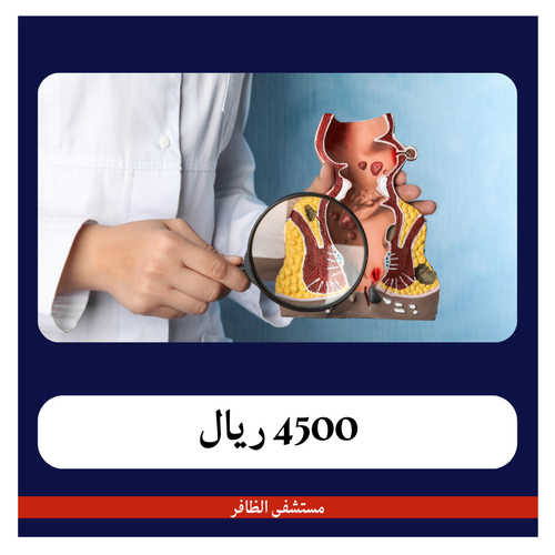 عملية البواسير بالربط 5000 ريال - دفعة أولى 450 ريال - مستشفى الظافر