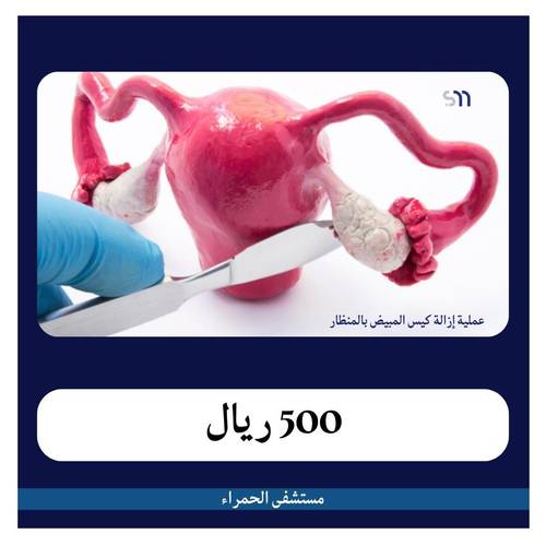 عملية إزالة كيس المبيض منظار بـ6300 دفعة أولى 500 ريال مستشفى الحمراء