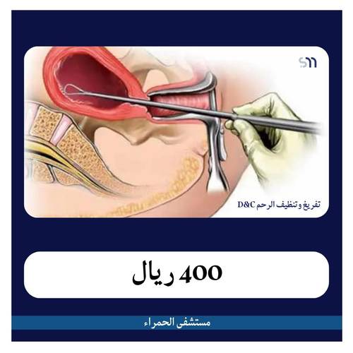 تفريغ وتنظيف الرحم (D&C) بـ 2600 دفعة أولى 400 ريال مستشفى الحمراء