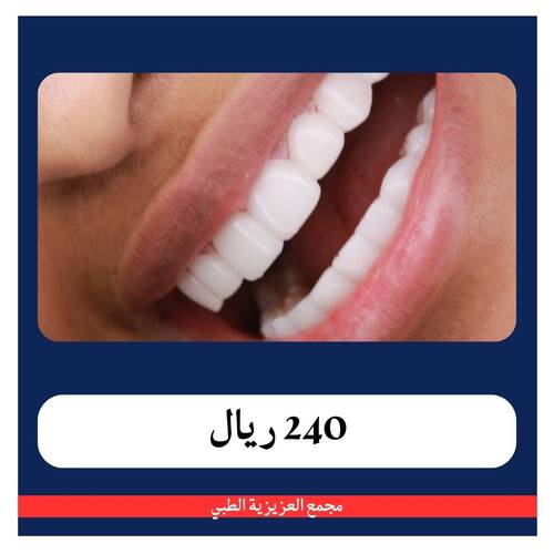 ‎ابتسامة هوليوود 6 اسنان شامل الكشف و الخطة العلاجية 3740 ريال -  دفعة اولى 240 ريال - مجمع العزيزية