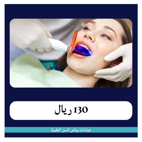 حشوة خلفية باليزر ب130 ريال -  دفعة أولى 30 ريال 