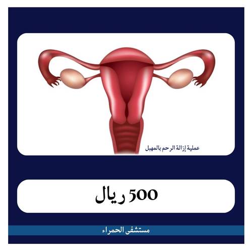 عملية إزالة الرحم بالمهبل بـ6500 دفعة أولى 500 ريال مستشفى الحمراء