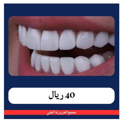 تركيب تاج زركون شامل الكشف و الخطة العلاجية بـ 390 ريال - دفعة اولى 40 ريال - مجمع العزيزية