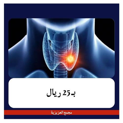 تحليل الغدة الدرقية  TSH بــ 100ريال دفعة اولى 25ريال مجمع العزيزية 