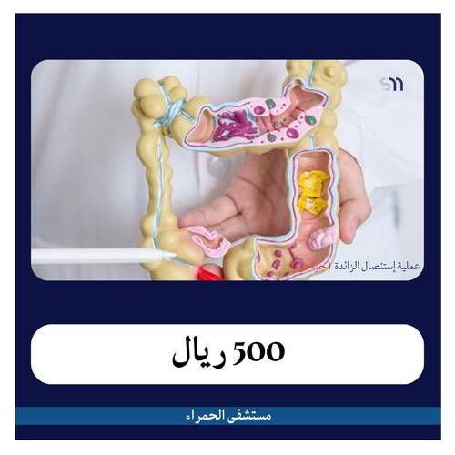 عملية استئصال الزائدة الدودية جراحة بـ5500 ريال دفعة أولى 500 ريال مستشفى الحمراء