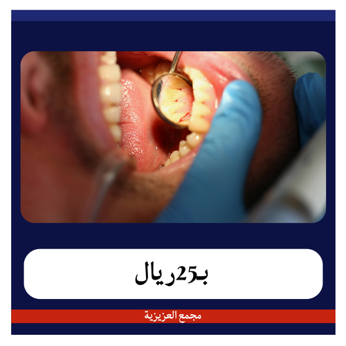 تنظيف الأسنان واللثة 75ريال دفعة أولى 25 ريال مجمع العزيزية