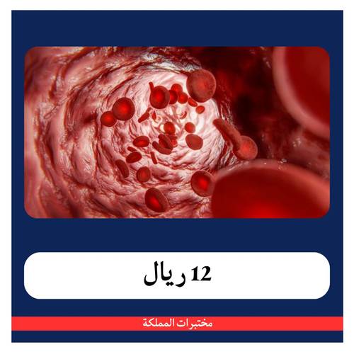 باقة فقر دم ب 237 ريال - دفعة أولى 12 ريال - مختبرات المملكة