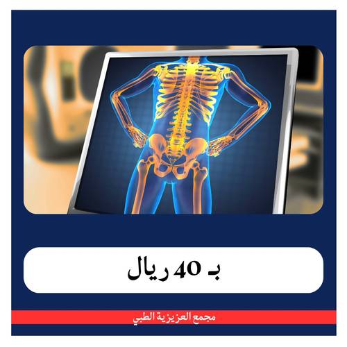 باقة العظام بــ 240 ريال - دفعة اولى 40 ريال - مجمع العزيزية