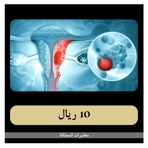 مخزون المبايض 208 ريال - دفعة أولى 10 ريال - مختبرات المملكة