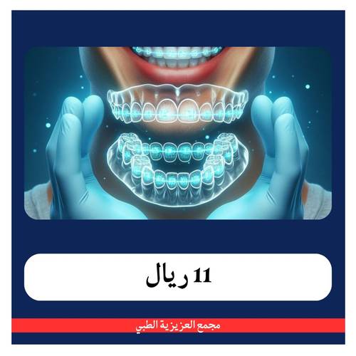 ‎كشفية + خطة علاجية ب 20 ريال - دفعة أولى 11ريال - مجمع العزيزية الطبي