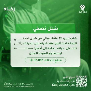 شلل نصفي 