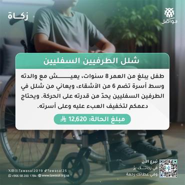 شلل الطرفيين السفليين 