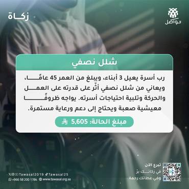 شلل نصفي 