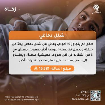 شلل دماغي
