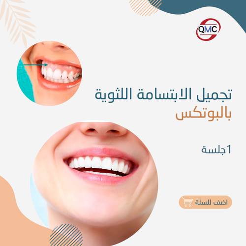 جلسة تجميل الابتسامة اللثويه