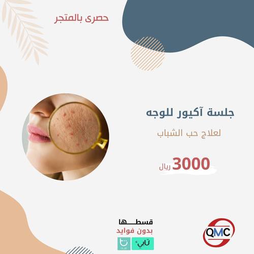 جلسة اكيور للوجه لعلاج حب الشباب