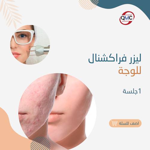 جلسة ليزر فراكشنال 