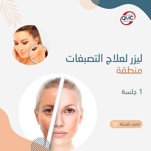 جلسة ليزر تصبغات 